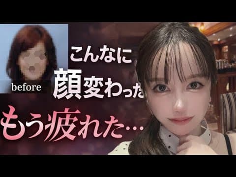 5000万課金YouTuber、整形に終止符？「もうやめたい…」衝撃告白の裏側
